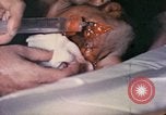 Image of wounded Marine Iwo Jima, 1945, second 10 stock footage video 65675077473