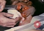 Image of wounded Marine Iwo Jima, 1945, second 11 stock footage video 65675077473