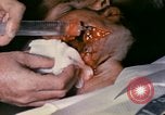 Image of wounded Marine Iwo Jima, 1945, second 12 stock footage video 65675077473