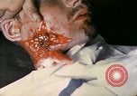 Image of wounded Marine Iwo Jima, 1945, second 20 stock footage video 65675077473