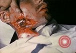 Image of wounded Marine Iwo Jima, 1945, second 21 stock footage video 65675077473