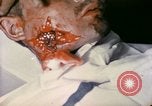 Image of wounded Marine Iwo Jima, 1945, second 22 stock footage video 65675077473