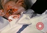 Image of wounded Marine Iwo Jima, 1945, second 23 stock footage video 65675077473