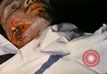 Image of wounded Marine Iwo Jima, 1945, second 24 stock footage video 65675077473