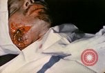 Image of wounded Marine Iwo Jima, 1945, second 25 stock footage video 65675077473