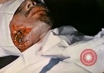 Image of wounded Marine Iwo Jima, 1945, second 26 stock footage video 65675077473