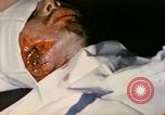 Image of wounded Marine Iwo Jima, 1945, second 27 stock footage video 65675077473