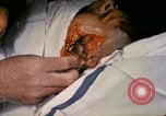 Image of wounded Marine Iwo Jima, 1945, second 28 stock footage video 65675077473