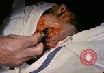 Image of wounded Marine Iwo Jima, 1945, second 29 stock footage video 65675077473