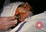 Image of wounded Marine Iwo Jima, 1945, second 31 stock footage video 65675077473