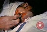 Image of wounded Marine Iwo Jima, 1945, second 32 stock footage video 65675077473