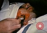 Image of wounded Marine Iwo Jima, 1945, second 36 stock footage video 65675077473