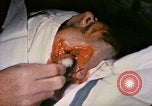 Image of wounded Marine Iwo Jima, 1945, second 37 stock footage video 65675077473