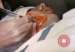 Image of wounded Marine Iwo Jima, 1945, second 44 stock footage video 65675077473