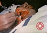 Image of wounded Marine Iwo Jima, 1945, second 45 stock footage video 65675077473