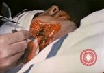 Image of wounded Marine Iwo Jima, 1945, second 46 stock footage video 65675077473