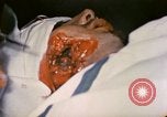 Image of wounded Marine Iwo Jima, 1945, second 49 stock footage video 65675077473
