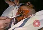 Image of wounded Marine Iwo Jima, 1945, second 51 stock footage video 65675077473