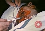 Image of wounded Marine Iwo Jima, 1945, second 52 stock footage video 65675077473