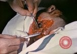 Image of wounded Marine Iwo Jima, 1945, second 53 stock footage video 65675077473