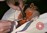 Image of wounded Marine Iwo Jima, 1945, second 54 stock footage video 65675077473