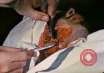 Image of wounded Marine Iwo Jima, 1945, second 55 stock footage video 65675077473
