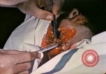 Image of wounded Marine Iwo Jima, 1945, second 56 stock footage video 65675077473