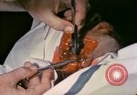 Image of wounded Marine Iwo Jima, 1945, second 58 stock footage video 65675077473