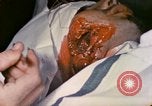 Image of wounded Marine Iwo Jima, 1945, second 59 stock footage video 65675077473