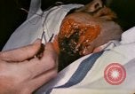 Image of wounded Marine Iwo Jima, 1945, second 60 stock footage video 65675077473
