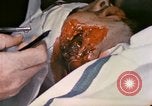 Image of wounded Marine Iwo Jima, 1945, second 61 stock footage video 65675077473