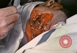 Image of wounded Marine Iwo Jima, 1945, second 62 stock footage video 65675077473
