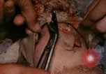 Standbild 3 Medizinischen Bataillon Okinawa Ryukyu Inseln, 1945, aus Sekunde 61 historischem Filmmaterial Videoclip 65675077482