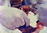 Image of operating a leg Okinawa Ryukyu Islands, 1945, second 3 stock footage video 65675077513