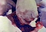 Image of operating a leg Okinawa Ryukyu Islands, 1945, second 7 stock footage video 65675077513