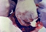 Image of operating a leg Okinawa Ryukyu Islands, 1945, second 8 stock footage video 65675077513