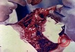 Image of operating a leg Okinawa Ryukyu Islands, 1945, second 9 stock footage video 65675077513