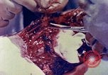 Image of operating a leg Okinawa Ryukyu Islands, 1945, second 13 stock footage video 65675077513