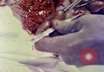 Image of operating a leg Okinawa Ryukyu Islands, 1945, second 14 stock footage video 65675077513