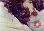 Image of operating a leg Okinawa Ryukyu Islands, 1945, second 15 stock footage video 65675077513