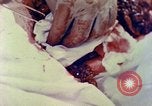 Image of operating a leg Okinawa Ryukyu Islands, 1945, second 16 stock footage video 65675077513