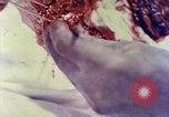 Image of operating a leg Okinawa Ryukyu Islands, 1945, second 17 stock footage video 65675077513