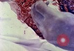 Image of operating a leg Okinawa Ryukyu Islands, 1945, second 18 stock footage video 65675077513