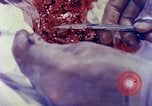 Image of operating a leg Okinawa Ryukyu Islands, 1945, second 19 stock footage video 65675077513