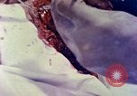 Image of operating a leg Okinawa Ryukyu Islands, 1945, second 21 stock footage video 65675077513