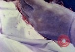 Image of operating a leg Okinawa Ryukyu Islands, 1945, second 22 stock footage video 65675077513