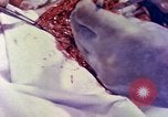 Image of operating a leg Okinawa Ryukyu Islands, 1945, second 24 stock footage video 65675077513