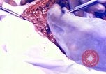 Image of operating a leg Okinawa Ryukyu Islands, 1945, second 25 stock footage video 65675077513