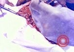 Image of operating a leg Okinawa Ryukyu Islands, 1945, second 26 stock footage video 65675077513