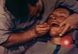 Image of dentist Okinawa Ryukyu Islands, 1945, second 35 stock footage video 65675077514